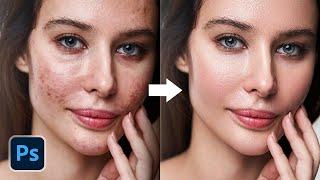 3 Superfast Ways to Auto-Repair Skin + Free Actions! - Photoshop Tutorial