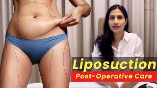 Instructions that You Must Follow After Liposuction | How to Wear Pressure Garments After Surgery