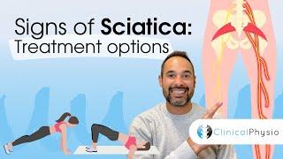 Sciatica Treatment Options | Expert Physio Guide