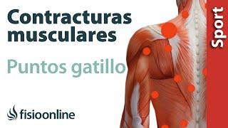 3 cosas que debes saber sobre las contracturas musculares y los puntos gatillo