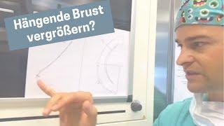 Kann ich eine hängende Brust mit Implantat vergrößern?