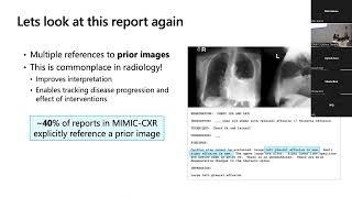 “Vision-language processing for radiology workflows”