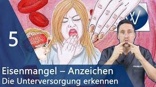 5 typische Eisenmangel Anzeichen: von Blässe, trockene Haut & Haarausfall bis Müdigkeit & Blutarmut