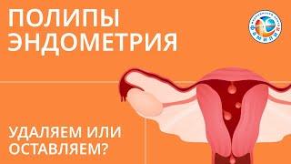  Полипы эндометрия. Удаляем или оставляем?