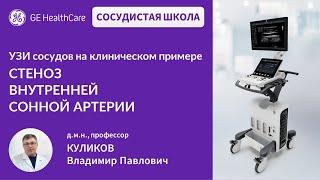 Сосудистая школа GE Healthcare. Стеноз внутренней сонной артерии. Сессия №10