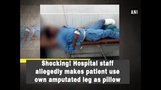 Shocking! Hospital staff allegedly makes patient use own amputated leg as pillow