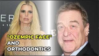 "Ozempic Face" and orthodontics