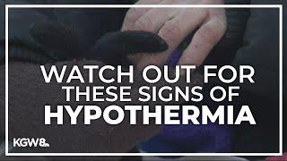 With temperatures dropping, here are the warning signs of hypothermia