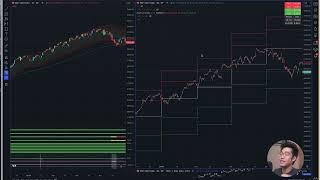 This Is How To Set Up TradingView