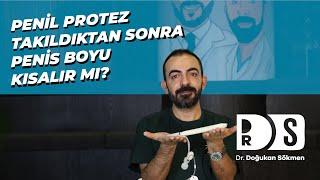 Penil Protez Takıldıktan Sonra Penis Boyu Kısalır Mı? - Dr. Doğukan Sökmen