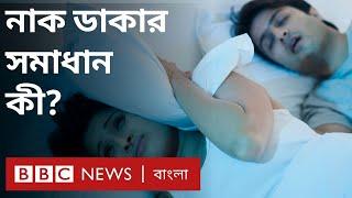 নাক ডাকা: কারণ কী, সমাধান কী? | BBC Bangla