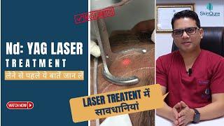 What precautions should be taken during Nd: YAG laser treatment? | SkinQure