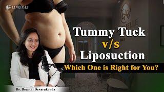 Tummy tuck vs Liposuction which is better | Tummy tuck treatment