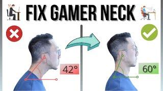 How to Fix Nerd Neck:  9 MINUTE DAILY ROUTINE [REDUCE NECK PAIN!]