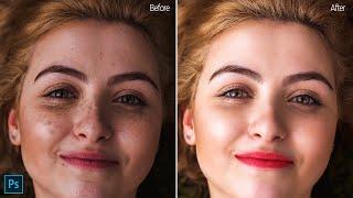 Advance Photo Editing : Skin Retouching in Photoshop 2020 SABKE SAB | Photo Retouching in Photoshop