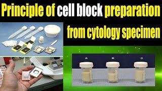 principle of cell block preparation from cytology specimen