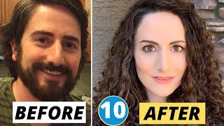 10 Sex Reassignment Surgeries (Male to Female)