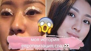 БЛЕФАРОПЛАСТИКА/ЕВРОПЕИЗАЦИЯ.Моя история