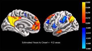 Intranetwork and Internetwork Default Mode Functional Connectivity