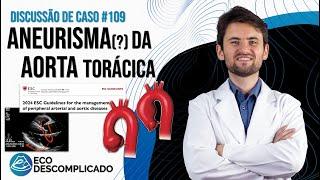 NOVA DIRETRIZ Avaliação da Aorta com o Ecocardiograma - Discussão de Casos #109 EcoDescomplicado