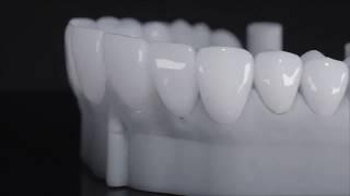 SEVIL PEARLY WHITE® FULL VENEERS