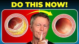 Don't Wait: DO THIS NOW to Clean your Arteries