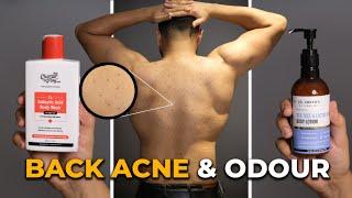 How to Treat & Prevent BACK ACNE | How To Smell Better Naturally | Sahil Gera