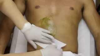 Male Stomach Hair Removal New York.Stomach Waxing For Men in NYC (Azulene)