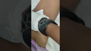 BRAZILIAN UNDERARMS  SUGARWAXING#shortvideo #short #shortsviral