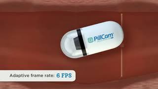 PillCam SB 3 Adaptive Frame Rate Video