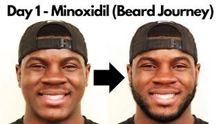 Day 1 - Minoxidil Beard Growth Journey