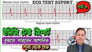 ECG TEST REPORT খুব সহজেই বুঝতে পারবেন। (পর্ব -১)  ইসিজি রিপোর্ট সহজ বাংলায়। HOW TO READ ECG REPORT