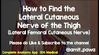 Lateral Femoral Cutaneous Nerve (LFCN) - How to find it with Ultrasound