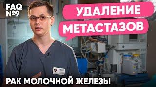 Нужно ли удалять метастазы? | Рак молочной железы