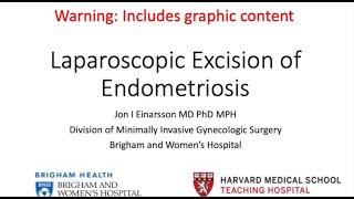 Laparoscopic Excision of Endometriosis - Brigham and Women's Hospital