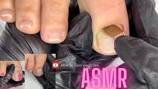 Her Toenails was so ugly and disgusting  | asmr pedicure | pedicure cleaning asmr | easy pedicure