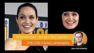 Normalization in Face Recognition with Dlib Facial Landmarks