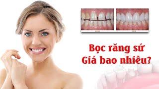 Bọc răng sứ giá bao nhiêu tiền? | Giá các loại răng sứ | Răng toàn sứ giá bao nhiêu? | Nha Khoa SG