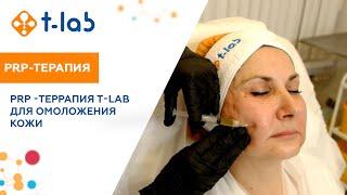 PRP-терапия T-LAB для омоложения кожи