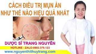 Nguyên nhân và cách điều trị mụn ẩn dưới da