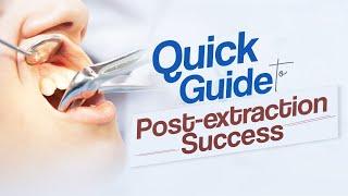 Quick Guide to Post-Extraction Success | Dentalkart