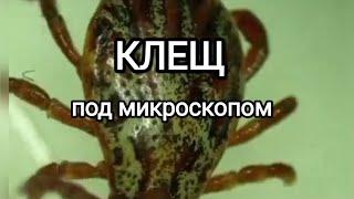 Клещ Под Микроскопом / Любопытные Факты