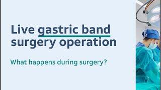 Gastric band surgery  weight loss operation Shaw Somers 🩺 the Fat Doctor