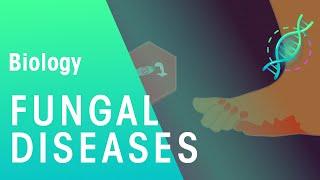 Fungal Diseases | Health | Biology | FuseSchool