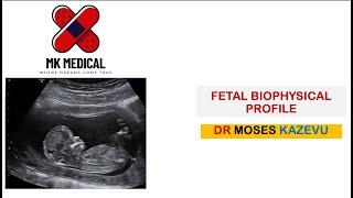 Fetal Biophysical Profile