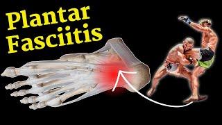 Fixing Plantar Fasciitis for MMA/Jiu-Jitsu Athletes (NO MORE Heel Pain!)