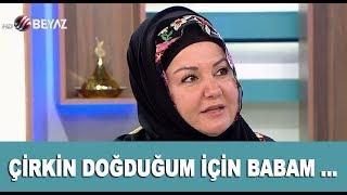 Çirkin doğduğum için babam beni sevmedi! İkbal Gürpınar duygulandırdı...