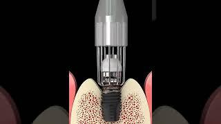 R brush animation. Neobiotech USA.