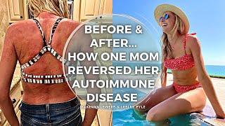 Before & After... How One Mom Reversed her Autoimmune Disease