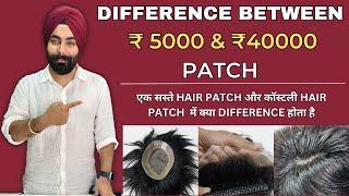 What is the Price of Different Hair Patches | Difference Between ₹5000 and ₹40000 | Hair Wig house